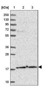 POLE3 Antibody in Western Blot (WB)