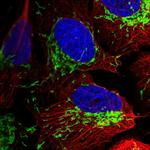 TOM70 Polyclonal Antibody