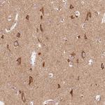 TOM70 Antibody in Immunohistochemistry (Paraffin) (IHC (P))