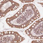 TOM70 Antibody in Immunohistochemistry (Paraffin) (IHC (P))
