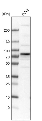 TOM70 Antibody in Western Blot (WB)