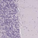 FCRL3 Antibody in Immunohistochemistry (Paraffin) (IHC (P))