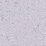 FCRL3 Antibody in Immunohistochemistry (Paraffin) (IHC (P))