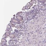 FCRL3 Polyclonal Antibody