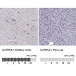 SLITRK3 Antibody
