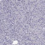 SLITRK3 Antibody in Immunohistochemistry (Paraffin) (IHC (P))