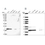 NDUFAF2 Antibody in Western Blot (WB)