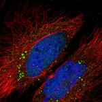 LCMT2 Polyclonal Antibody