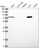 LCMT2 Antibody in Western Blot (WB)