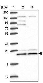 BERP Antibody in Western Blot (WB)