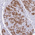 MVD Polyclonal Antibody