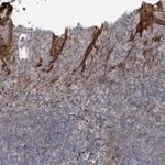 COL5A3 Polyclonal Antibody