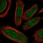 GALK2 Polyclonal Antibody