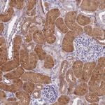 GALK2 Antibody in Immunohistochemistry (Paraffin) (IHC (P))