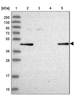 GALK2 Antibody in Western Blot (WB)