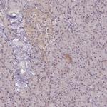 PKC beta Antibody in Immunohistochemistry (Paraffin) (IHC (P))
