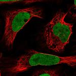 NUP50 Polyclonal Antibody