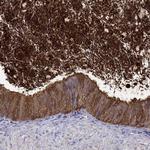 BSPH1 Antibody in Immunohistochemistry (Paraffin) (IHC (P))