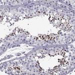 C13orf28 Antibody in Immunohistochemistry (Paraffin) (IHC (P))