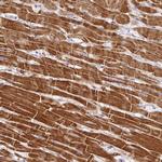 DAPK1 Polyclonal Antibody