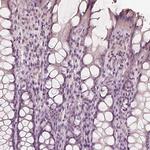 Calreticulin 3 Antibody in Immunohistochemistry (Paraffin) (IHC (P))