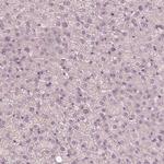 Calreticulin 3 Antibody in Immunohistochemistry (Paraffin) (IHC (P))