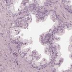 Calreticulin 3 Antibody in Immunohistochemistry (Paraffin) (IHC (P))