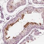 Calreticulin 3 Antibody in Immunohistochemistry (Paraffin) (IHC (P))