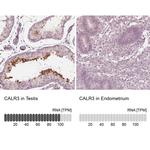 Calreticulin 3 Antibody