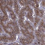 PTH Polyclonal Antibody