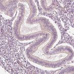 KCNQ1 Polyclonal Antibody