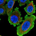 HDAC8 Polyclonal Antibody