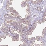 STYK1 Antibody in Immunohistochemistry (Paraffin) (IHC (P))