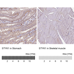 STYK1 Polyclonal Antibody