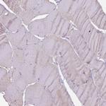 STYK1 Antibody in Immunohistochemistry (Paraffin) (IHC (P))