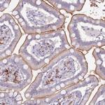 STYK1 Antibody in Immunohistochemistry (Paraffin) (IHC (P))