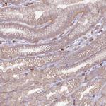 STYK1 Antibody in Immunohistochemistry (Paraffin) (IHC (P))