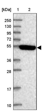 STYK1 Antibody in Western Blot (WB)