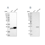GUK1 Antibody in Western Blot (WB)