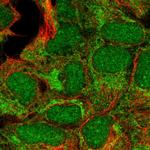 CBX6 Polyclonal Antibody