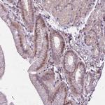 CBX6 Antibody in Immunohistochemistry (Paraffin) (IHC (P))