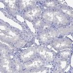 Melan-A Antibody in Immunohistochemistry (Paraffin) (IHC (P))