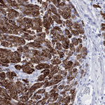 Melan-A Polyclonal Antibody