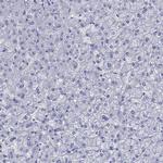 Melan-A Antibody in Immunohistochemistry (Paraffin) (IHC (P))