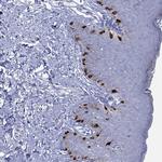 Melan-A Antibody in Immunohistochemistry (Paraffin) (IHC (P))