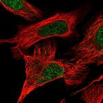 DOCK1 Polyclonal Antibody