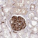 DOCK1 Antibody in Immunohistochemistry (Paraffin) (IHC (P))