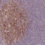 RFTN1 Polyclonal Antibody