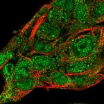 SERPINA10 Polyclonal Antibody