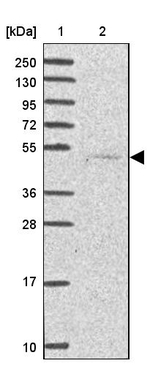 SERPINA10 Antibody in Western Blot (WB)